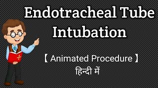 Endotracheal Tube Intubation  Animated Procedure  Hindi [upl. by Ailahs]