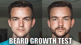 CPH Grooming vs Minoxidil  I tried both Beard Growth [upl. by Lody519]