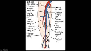 Deep Vein Thrombosis How to handle DVTs [upl. by Anuhsal859]