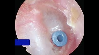 How the Inner Ear Balance System Works  Labyrinth Semicircular Canals [upl. by Ehcram320]