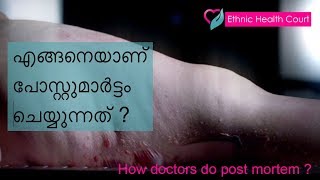 How doctors do post mortem   ഡോകടർ എങ്ങനെയാണ് പോസ്റ്റുമാർട്ടം ചെയ്യുന്നത്   Ethnic Health Court [upl. by Sirapal]