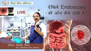 देखिये Endoscopy की जाँच कैसे होती है   देखिये LIVE  Dr VK Mishra MD DMGastro [upl. by Nivrad]