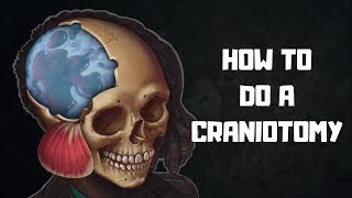 How to do a craniotomy [upl. by Belamy29]