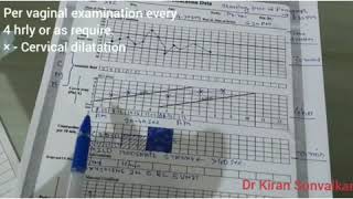 Partograph  How to Use it [upl. by Auqenahc289]