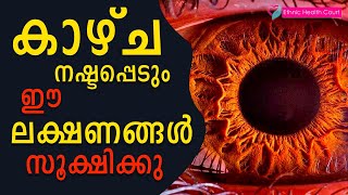 കാഴ്ച നഷ്ടപ്പെടുത്തുന്ന നേത്രരോഗങ്ങൾപരിഹാരങ്ങളും  Eye diseases  Ethnic Health Court [upl. by Adnohral26]