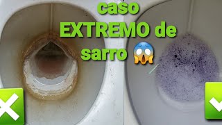 Como limpiar baño lleno de SARRO [upl. by Anaid]