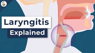 Why Do You Lose Your Voice  Laryngitis Explained [upl. by Ailad]