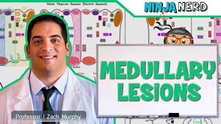 Medullary Lesions Medial and Lateral Medullary Syndromes [upl. by Bondie229]