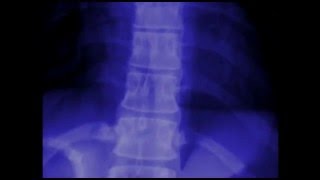 Cervical Spondylosis Stretches amp Exercises  Ask Doctor Jo [upl. by Mufi461]