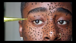 I TRIED HENNA FRECKLES ON MY DARK SKIN ANDD [upl. by Floss]