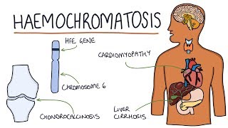 Understanding Haemochromatosis [upl. by Gaston379]