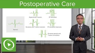 Postoperative Care – Surgery  Lecturio [upl. by Eerihs992]