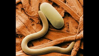 What are nematodes [upl. by Ahsilrae]