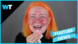 Permanent FRECKLE Beauty FAIL Goes VIRAL [upl. by Karb]