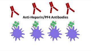 Treating Patients With Essential Thrombocytopenia [upl. by Enitsirhk956]