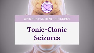 What are TonicClonic Seizures [upl. by Enybor]