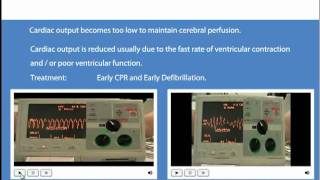 Advanced Life Support Shockable and Non Shockable Rhythms [upl. by Eerat390]