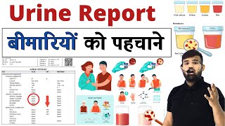 Urine Report  बीमारियां को पहचाने  Medicine  Treatment  Doctor  Hospital  Medical  MBBS [upl. by Keg]