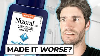 Nizoral Shampoo For Hair Loss  THE TRUTH [upl. by Rimas]