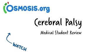 Cerebral Palsy  Clinical Review [upl. by Jovia]