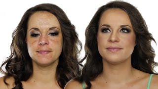 How To Cover Hyperpigmentation  Skin Pigmentation Using MakeUp  Shonagh Scott  ShowMe MakeUp [upl. by Attenov256]