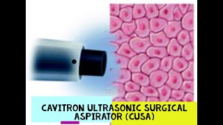 CAVITRON ULTRASONIC SURGICAL ASPIRATOR  CUSA [upl. by Riehl]