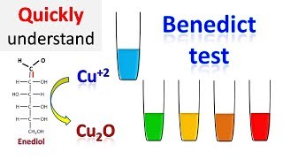 Benedicts test [upl. by Lenno]