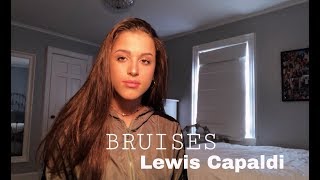 ally salort  bruises lewis capaldi cover [upl. by Hax946]