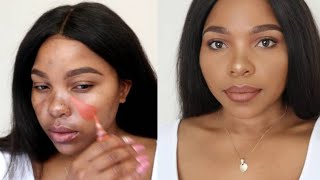 HOW TO COVER HYPERPIGMENTATION AND DARK SPOTS ON BROWN SKIN [upl. by Essirahc]