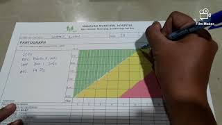 HOW TO PARTOGRAPH  LABOR MONITORING [upl. by Leonerd]