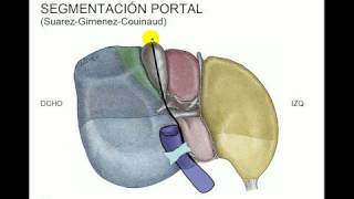 Segmentacion hepática [upl. by Orsola]