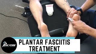 Top 10 Ways To Cure Plantar Fasciitis [upl. by Sana]