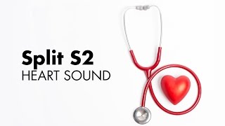 Fixed Split S2  Heart Sounds  MEDZCOOL [upl. by Animas]