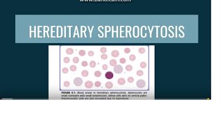 Hereditary Spherocytosis [upl. by Tocs]