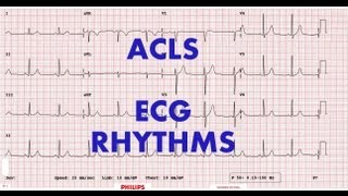 ACLS  ECG rhythm recognition amp management Part 1 [upl. by Otreblig399]