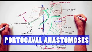 Portocaval Anastomoses  ANATOMY Tutorial [upl. by Hasty562]