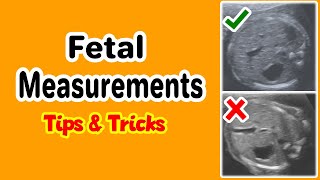 Fetal Measurements Tips and Tricks [upl. by Schouten343]