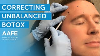 Correcting Unbalanced Botox at His Follow Up Appointment  AAFE [upl. by Ruhtua]