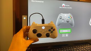 Xbox Series XS How to PairSync Controllers With Wired USB Cable Tutorial For Beginners [upl. by Pam]