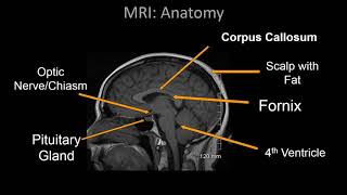 Normal Brain MRI Anatomy  Neuroradiology Made simple [upl. by Lletniuq744]