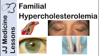 Familial Hypercholesterolemia  Genetics Pathophysiology Symptoms and Treatment [upl. by Ede193]