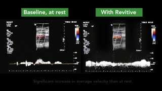 How REVITIVE increases circulation [upl. by Webber]