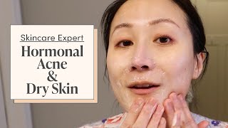 GRWM  my morning KOREAN SKINCARE routine acne prone  sensitive skin [upl. by Nosiram]