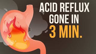 Peptic Ulcer Part06 Mechanism of Action of Antacid  Antacids  AntiAcids use in Peptic Ulcer [upl. by Landre]