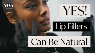 Easy Aftercare for Botox amp Fillers  Heres What to Do after Your Treatment [upl. by Katz]