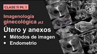 111  Imagen Ginecológica Métodos de estudio y patología endometrial [upl. by Notlrac980]