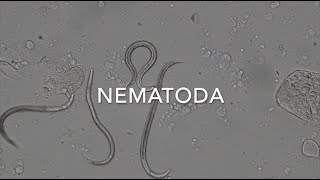 Nematodes [upl. by Ynatterb613]