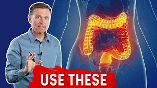 What is Ulcerative Colitis – Causes Symptoms amp Treatment by DrBerg [upl. by Ahsiri481]