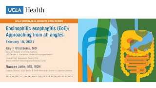 What is the Main Cause of Esophageal Cancer [upl. by Harvard]