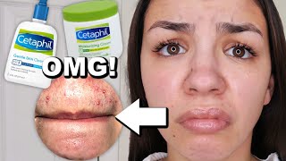 I Used Cetaphil Skincare For One Week [upl. by Graham]